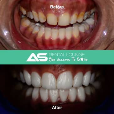 Slider image (2) AS Dental Lounge